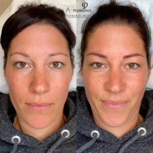 PMU Mainz permanent Ästhetik