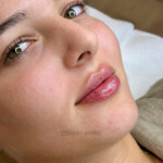 Permanent Aesthetik Lippenunterspritzung Russian Lips mainz frankfurt wiesbaden